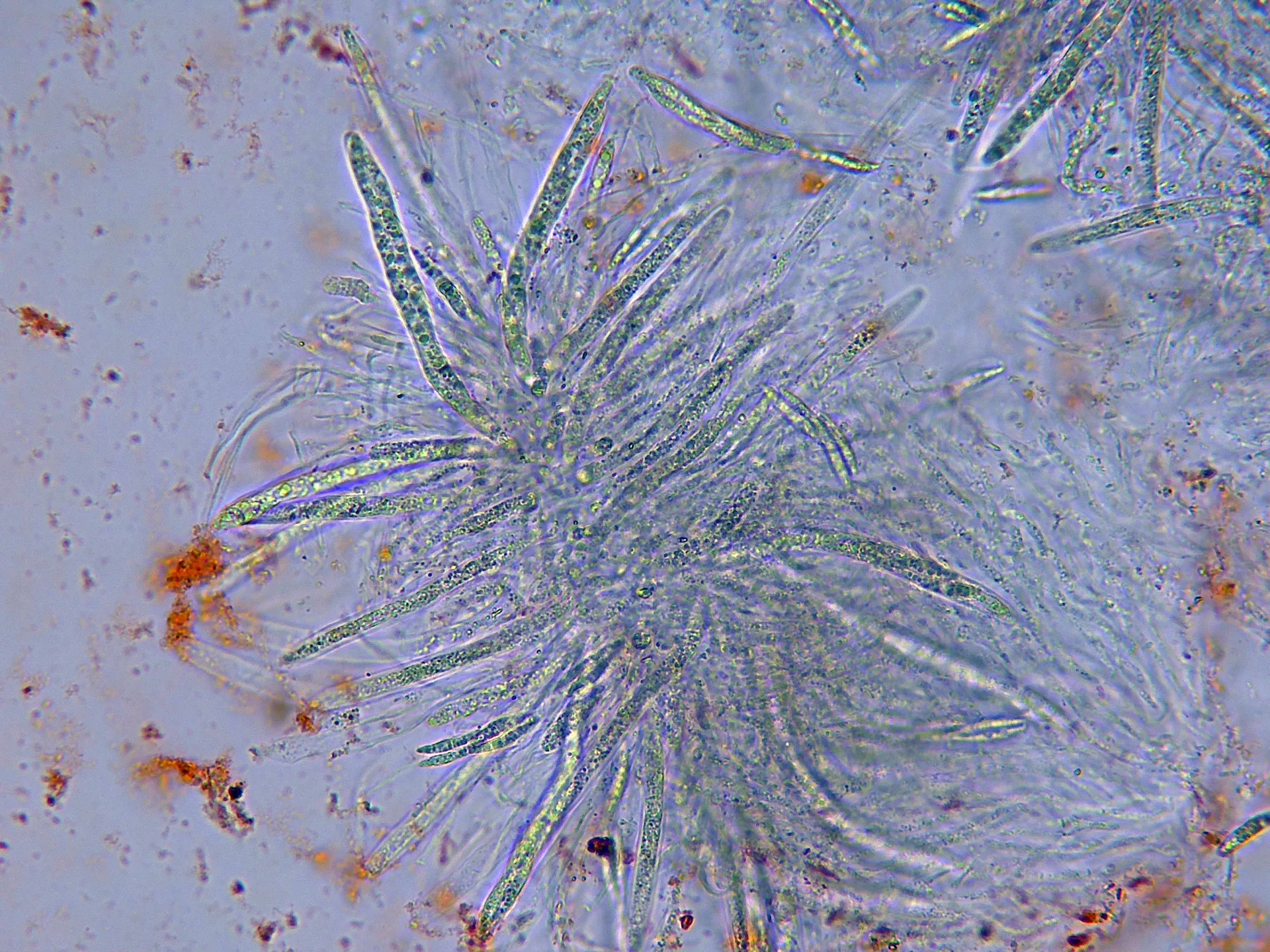 Microscopía de Menispora glauca - 16 - Ascos x 400-001
